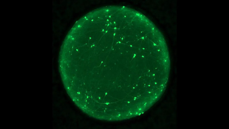 Brain organoid with neurons highlighted in green.