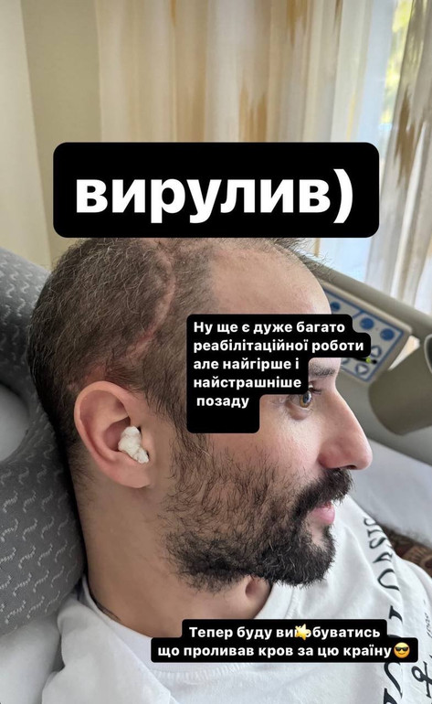 Фото Віктора Розового через 1,5 місяця після поранення.