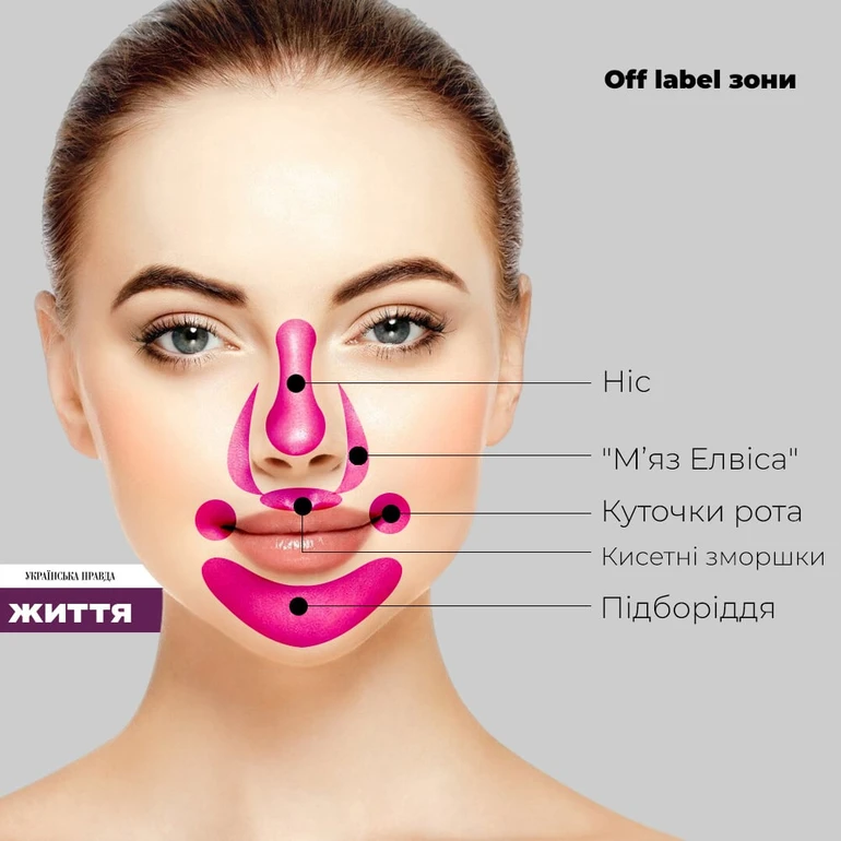 Off label зони для ботоксу