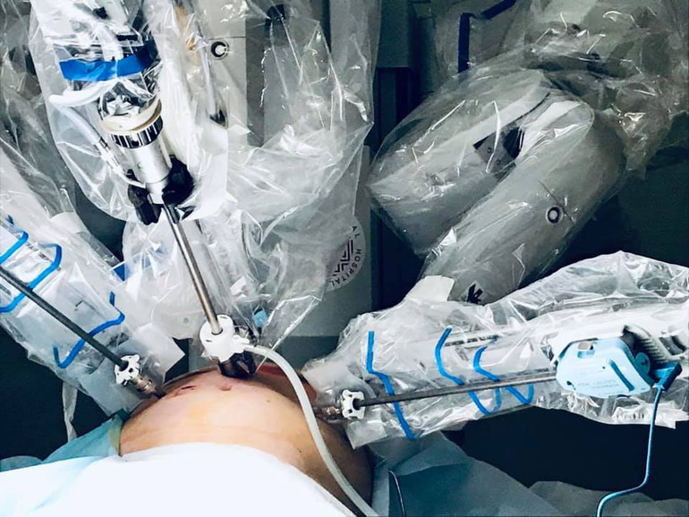 Перший пацієнт Першого медоб’єднання Львова під час операції з допомогою робота Da Vinci