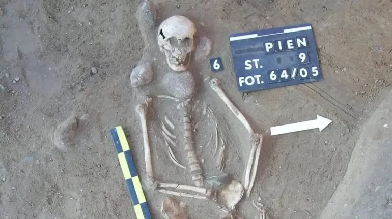 Могила жінки віком близько 60 років з ознаками аневризми мозку