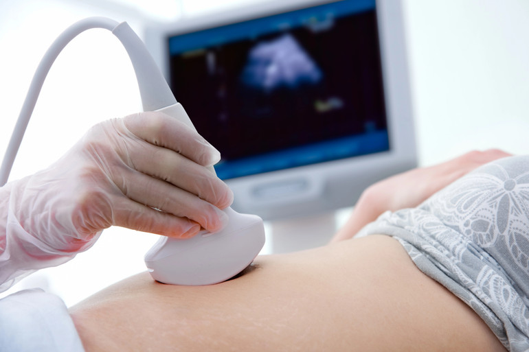 Ultrasound to determine the stock of eggs