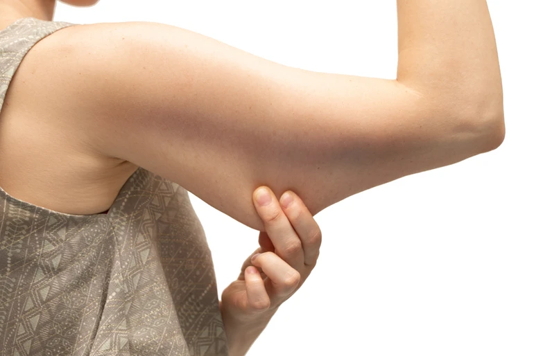 обвисання шкіра