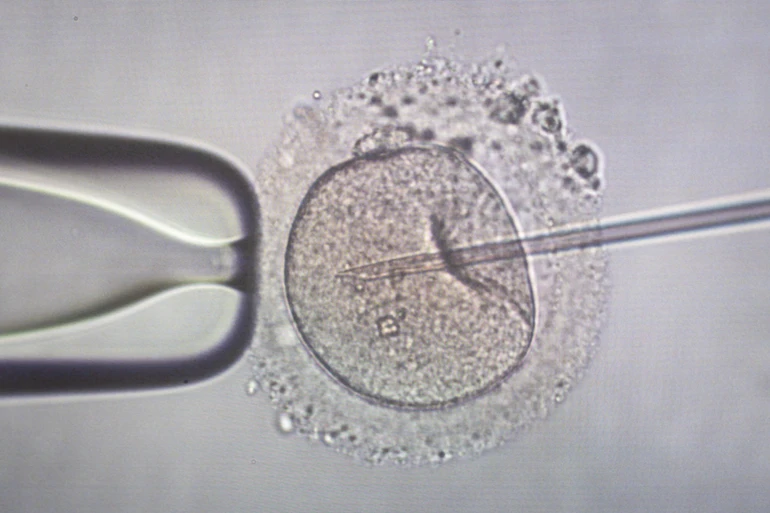 Запліднення ІКСІ