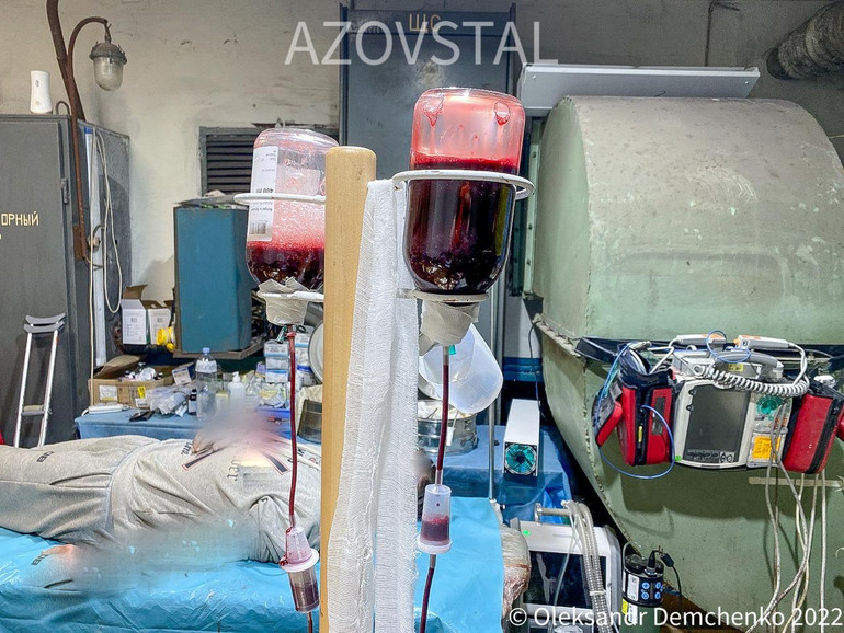 Операції під землею, без повноцінної стерильності, але з повною відповідальністю за кожного пацієнта