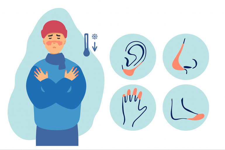 обмороження рук та носа