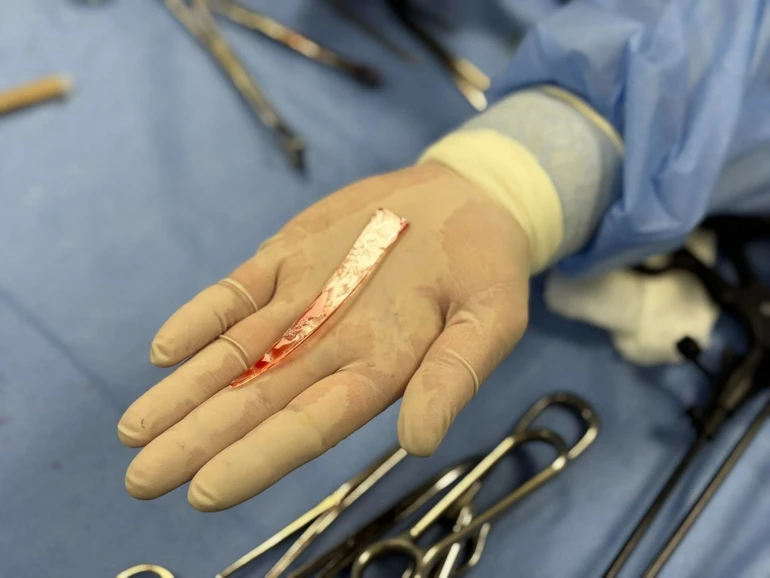 Наразі чоловіка виписали з лікарні