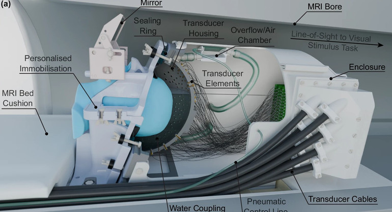 Фото пристрою для ультразвукової дії на мозок