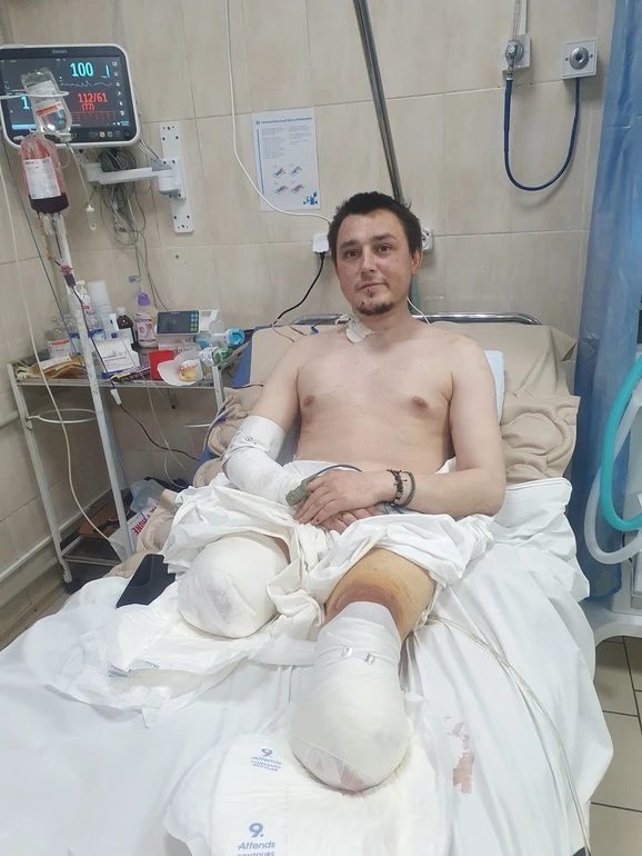 Роман залишився без обох ніг, але вижив у безнадійній ситуації