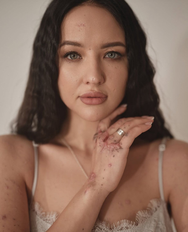 Wounded women in a photo projection