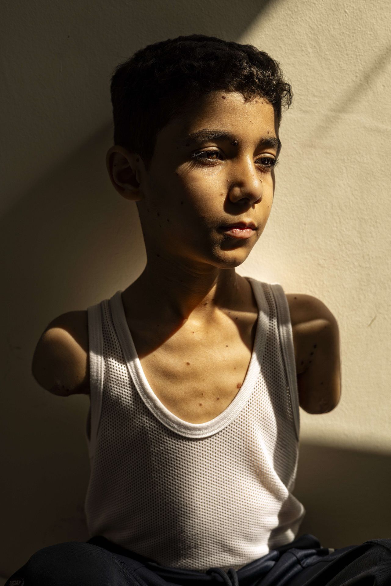 Nine -year -old boy from Gaza